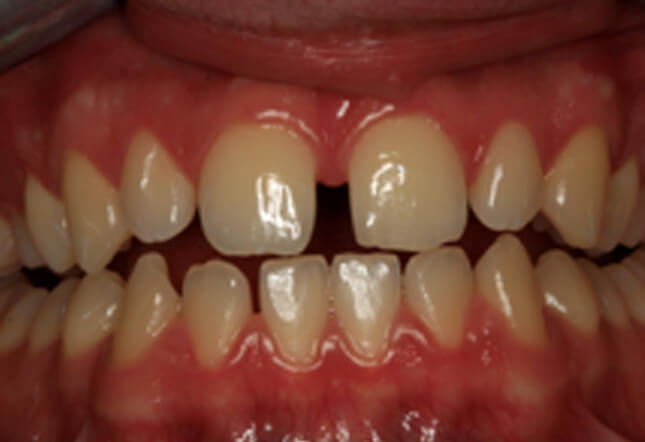 Before